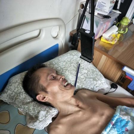 Brother Zhang Jun seen here lying in bed, is a former martial arts actor who had been paralyzed and is now taken care of by the volunteers.